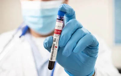 DAS Deva participă la Campania „Luna Națională a informării despre bolile transmisibile”